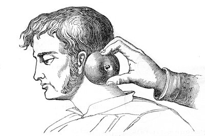 Aplicación de sanguijuelas con una manzana - grabado en “La Santo Universelle - Guía Médica para Familias” 1852 de Unknown artist