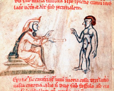 El doctor quema al paciente en áreas dolorosas con hierros calientes Miniatura del manuscrito "De Medicina cauteriorum secundum Brunum, Rugerium et Rolthe" siglo XIII de Unknown artist