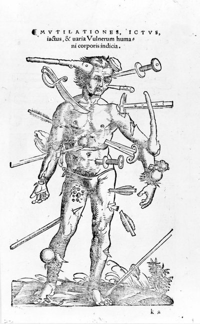 Todo tipo de heridas traumáticas de guerra. Siglo XVI de Unknown artist