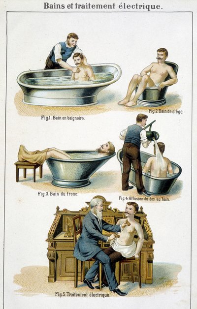 Baños y tratamiento eléctrico: 1) Bañera, 2) Baño de asiento, 3) Baño de tronco, 4) Baño de espalda, 5) Tratamiento eléctrico - en "Bilz, Medicación Natural", finales del siglo XIX de Unknown artist