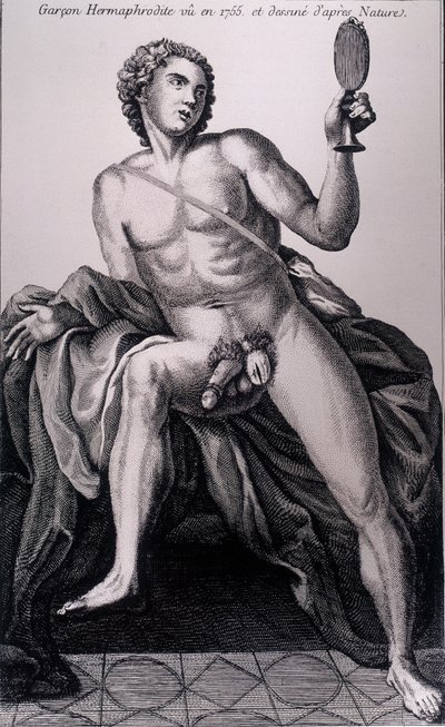 Niño hermafrodita visto en 1755 y dibujado del natural de Unknown artist