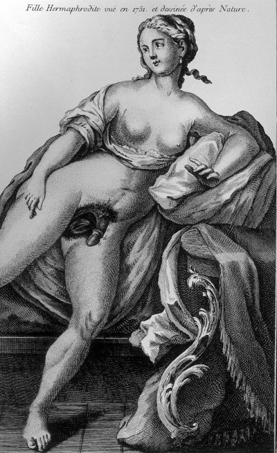 Niña hermafrodita vista en 1751 y dibujada del natural. de Unknown artist