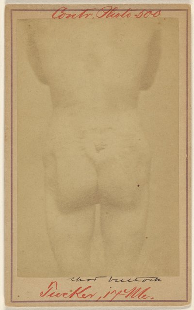 [Jno. E. Tucker, disparo en las nalgas, víctima de la Guerra Civil] de Unknown artist