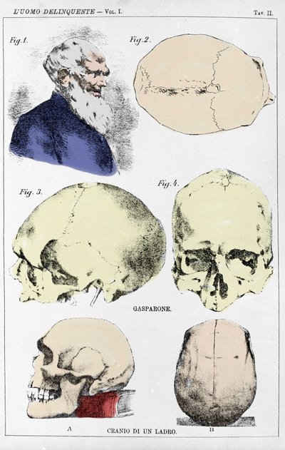 Estudio sobre la morfología de un cráneo delincuente por el criminólogo italiano de Unknown artist