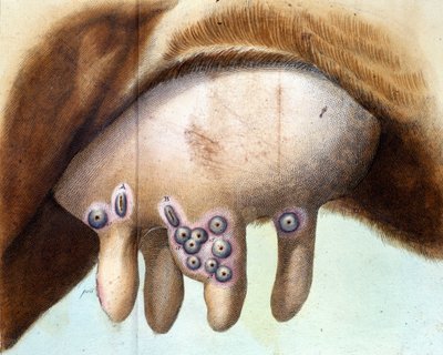 La ubre de la vaca utilizada para inocular la vacuna contra la viruela por Luigi Sacco (1769-1836) en enero de 1801. Lámina médica de “Tratado de Vacunación” de Luigi Sacco, Milán de Unknown artist