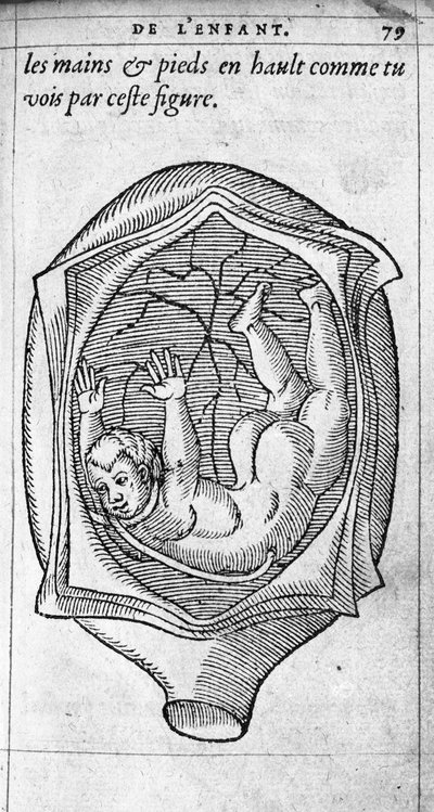 La posición del feto en el útero durante el embarazo. Grabado de “De la generación de los niños” del médico y cirujano francés Ambroise Paré (1509-1590) siglo XVI de Unknown artist