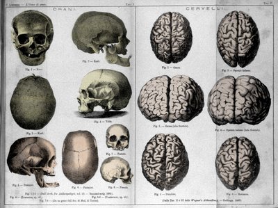 Las pieles y cerebros de hombres geniales. Estudio de Cesare Lombroso (1835-1909), criminólogo italiano en “El Hombre de Genio” de Unknown artist