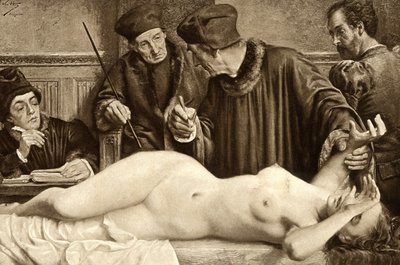 Brujería. Los científicos buscan un lunar en el cuerpo de una bruja, para pellizcarlo y estudiar la reacción. Ilustración de E. Van Hoove. 1888 de Unknown artist