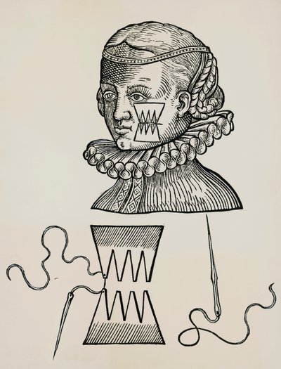 Herida en la mejilla tratada con apósitos para evitar marcas de puntos en la piel de Unknown artist