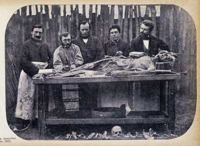 Disección, c.1865 de Unknown photographer