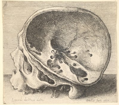 Cráneo seccionado en perfil hacia la izquierda con el lado izquierdo del cráneo removido de Wenceslaus Hollar
