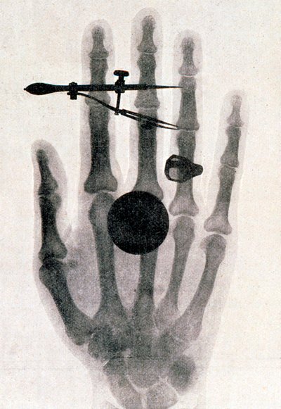 Radiografía de la mano de la esposa de Wilhelm Roentgen, 1896 de Wilhelm Conrad Rontgen