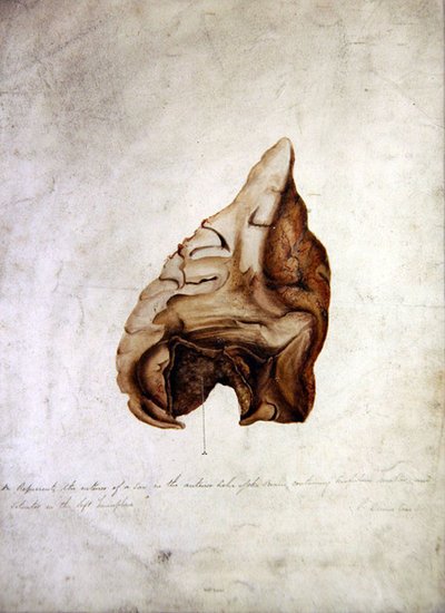 Estudio del cerebro I, c.1850 de William Lover