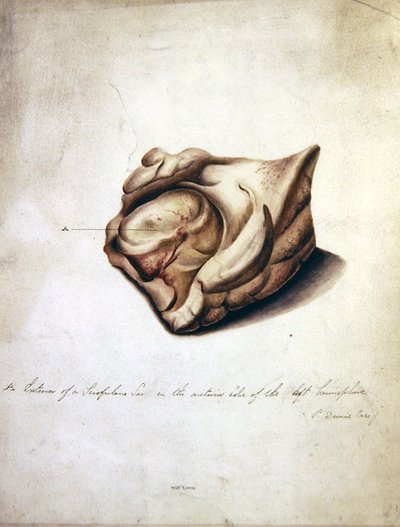Estudio del cerebro II, c.1850 de William Lover