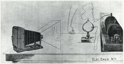 Radiología diagnóstica, radiografías de John Pardon