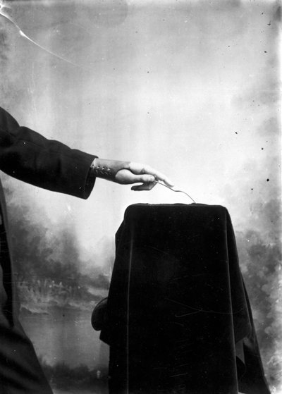 Prótesis Hombre con una mano protésica de Frederick (attr. to) Barnard