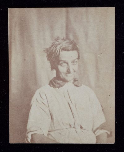 Psiquiatría Retrato de un paciente, Asilo del Condado de Surrey, c. 1852 de John Pardon