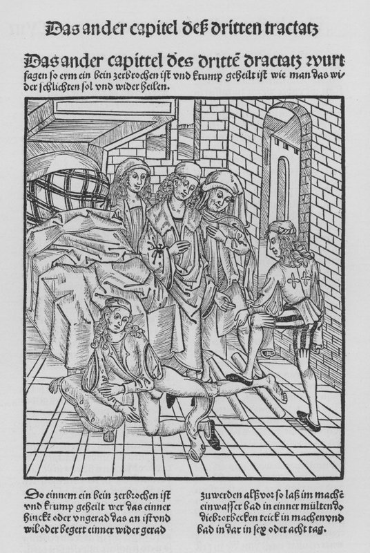 El libro de Cirurgia de Hieronymus Brunschwig de (after) German School
