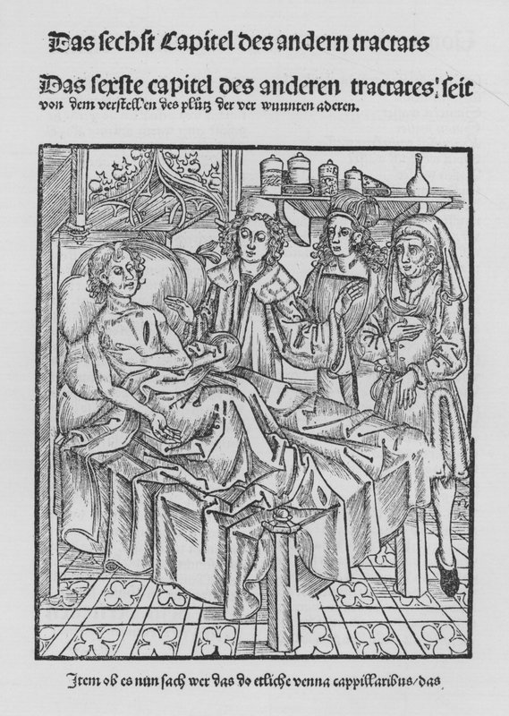 El libro de Cirurgia de Hieronymus Brunschwig de (after) German School