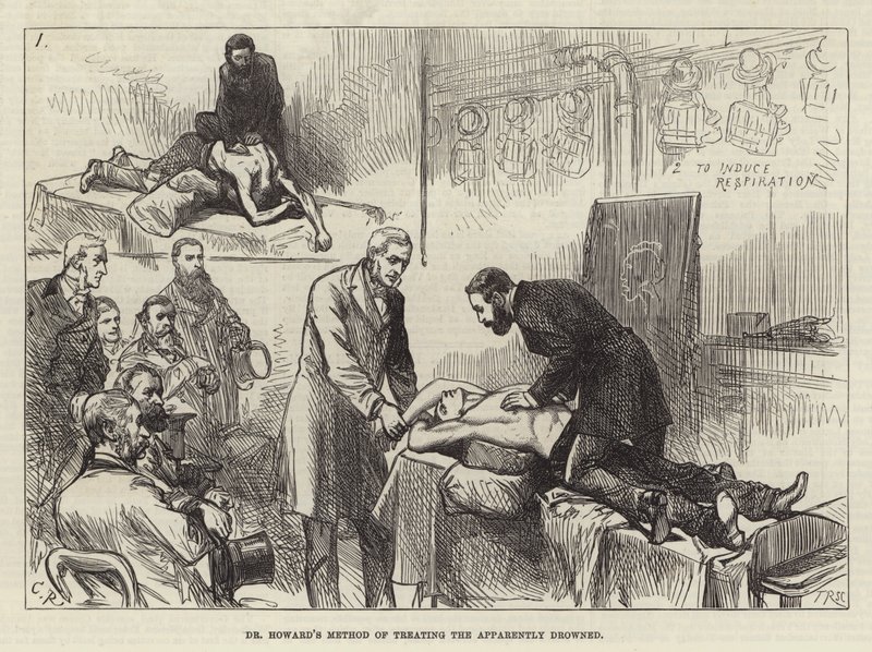 El método del Dr. Howard para tratar a los aparentemente ahogados de Sir John Charles Robinson