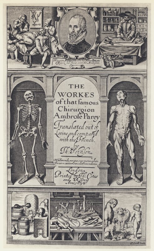 A Pare, Las obras, T Cotes y R Young 1634 de English Photographer