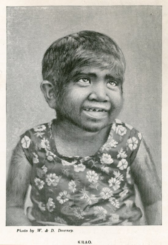Krao, El Eslabón Perdido, exhibido en el Acuario, Westminster, Londres, en 1887 de English Photographer
