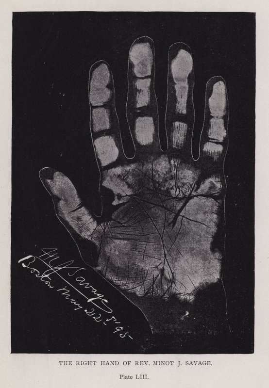 La mano derecha del Rev. Minot J Savage de English Photographer