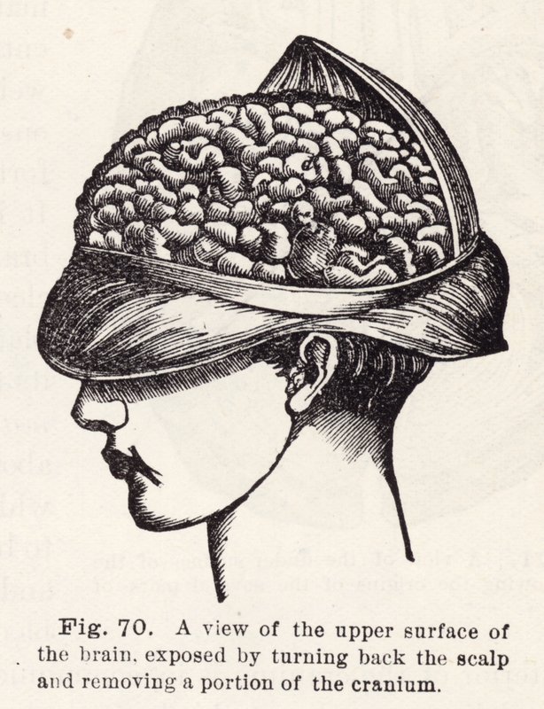 Vista de la superficie superior del cerebro, expuesta al retroceder el cuero cabelludo y remover una porción del cráneo (grabado) de English School
