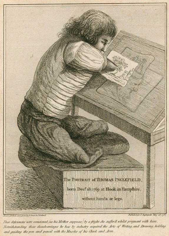 Thomas Inglefield, nacido el 18 de diciembre de 1769 en Hook, Hampshire, sin brazos ni piernas de English School