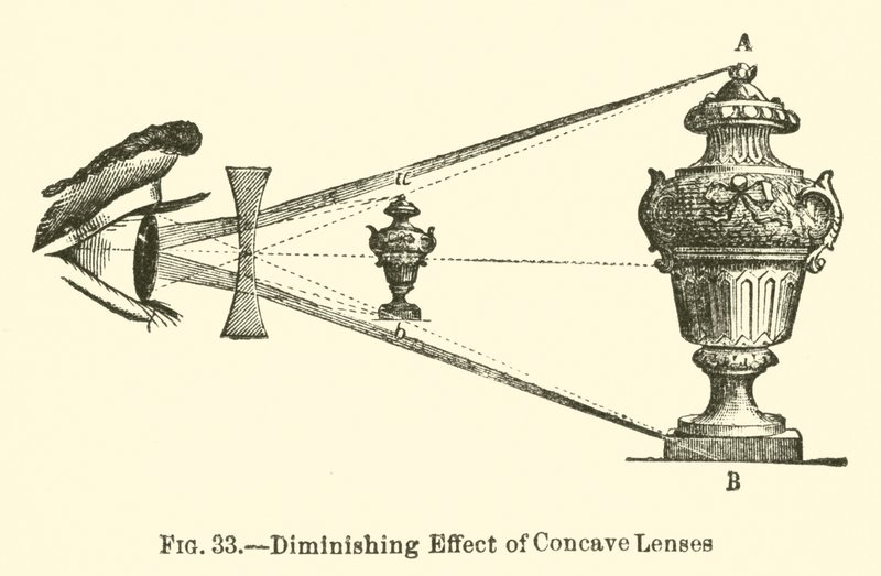 Efecto de Disminución de Lentes Cóncavas de European School