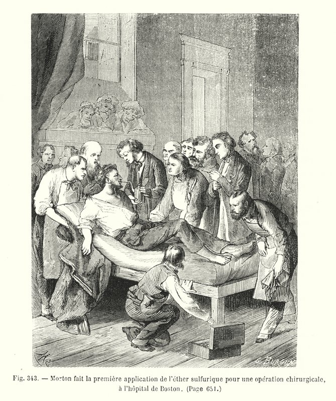 Morton hace la primera aplicación de éter sulfúrico para una operación quirúrgica, en el hospital de Boston de European School