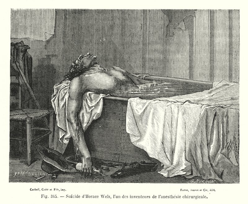 Suicidio de Horace Wels, uno de los inventores de la anestesia quirúrgica de European School
