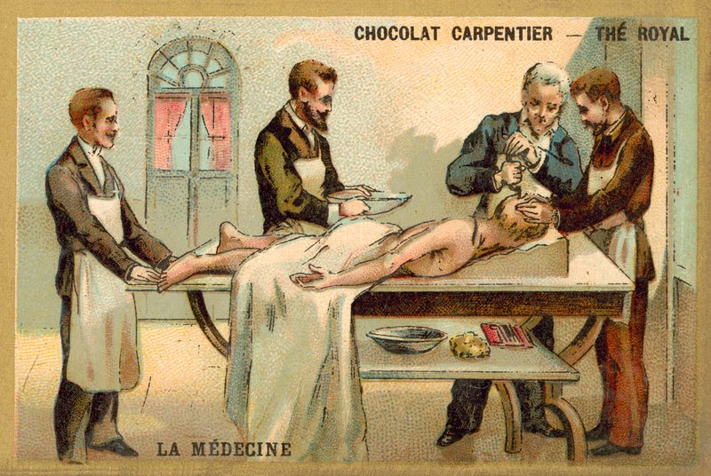 Trepanación de French School
