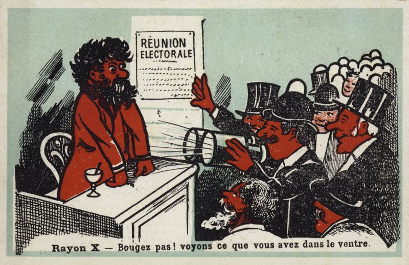 Rayos X - ¡No te muevas! Veamos qué tiene en el estómago de French School