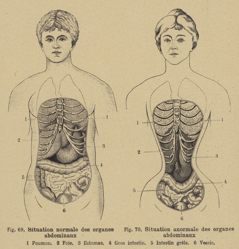 Situación normal de los órganos internos del abdomen en hombres y mujeres de German School