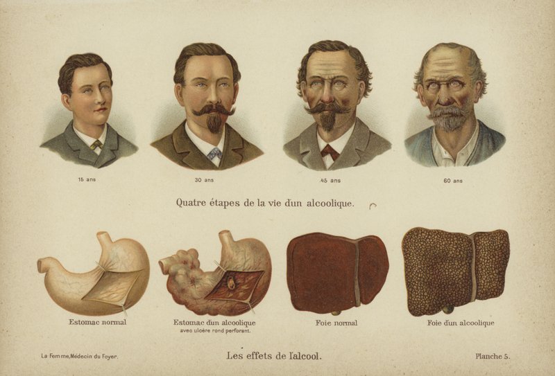 Los efectos del abuso del alcohol de German School