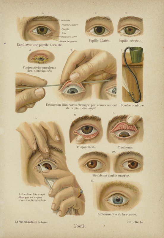 El ojo de German School