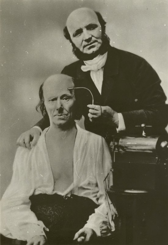Neurólogo francés Duchenne de Boulogne usando su aparato de electrofisiología en un anciano de Guillaume Benjamin Armand Duchenne de Boulogne
