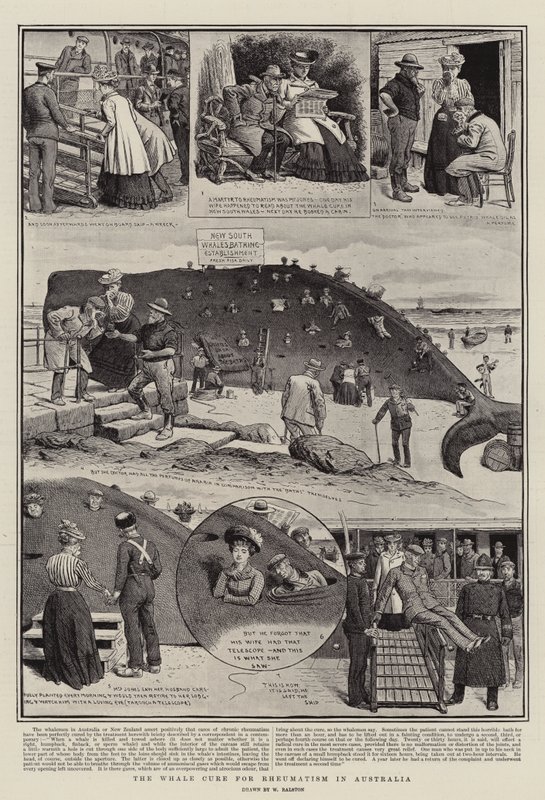 La Cura de la Ballena para el Reumatismo en Australia de William Ralston