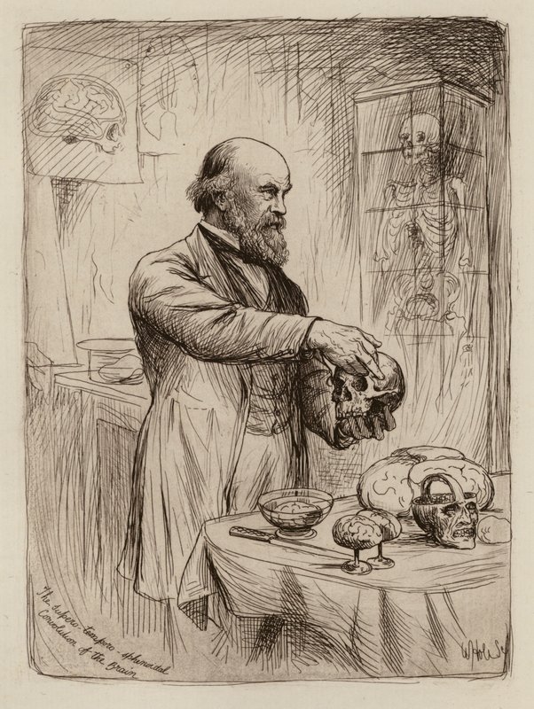 William Turner, profesor de anatomía (grabado) de William Brassey (after) Hole
