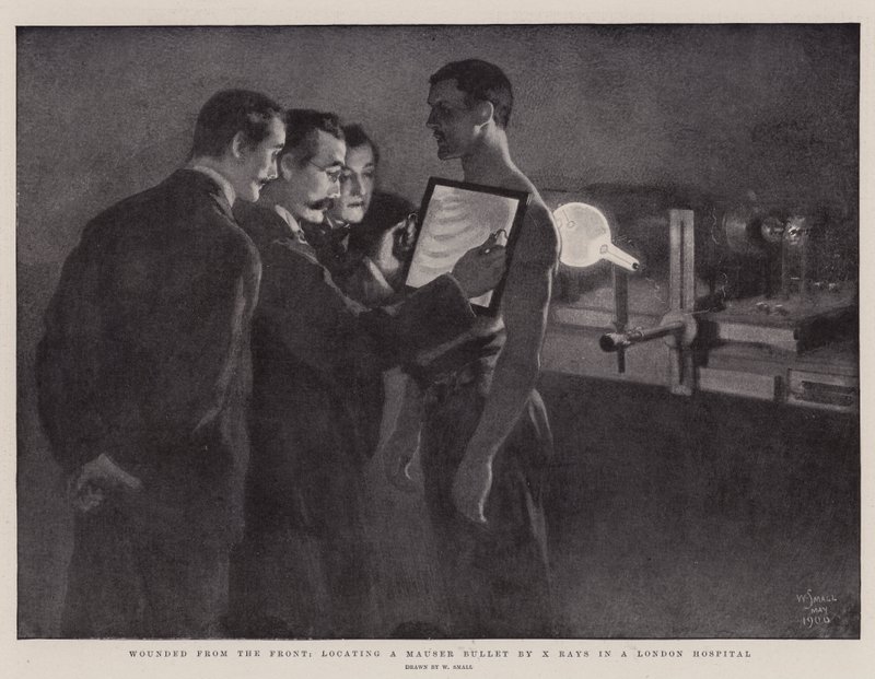 Heridos del Frente, localizando una bala Mauser con rayos X en un hospital de Londres de William Small