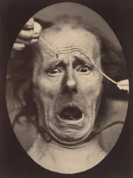 Electro-Fisiología, Figura 64, 1854-56, impreso en 1862