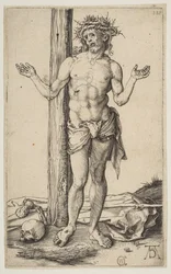 Hombre de dolores con los brazos extendidos