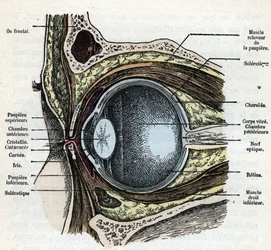 Corte vertical de un globo ocular con catarata Grabado de "Nature and Man" de Rengade 1881 Colección particular