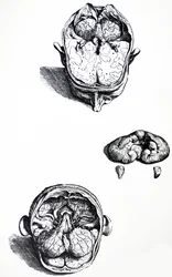 Las Placas del Séptimo Libro de De Humani Corporis Fabrica