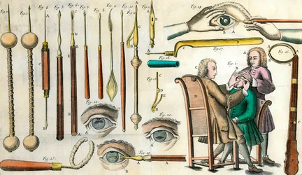 Cirugía en el siglo XVIII: operación ocular. Instrumentos para la operación de cataratas y formación de pupila artificial. Grabado en "Institutionis chirurgicae" de Lorenzo Heister