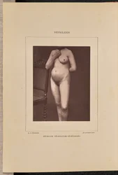 Sífilis vesicular generalizada