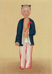 Niño con viruela