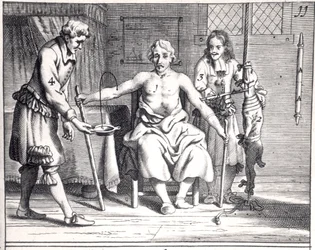 Transfusión de sangre de un perro, de Armamentarii Chirurgici de Johannes Schultes (1595-1645), publicado en Ámsterdam, 1671