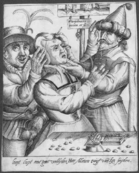 Trepanación, grabada por H. Weydmans (siglo XVI)
